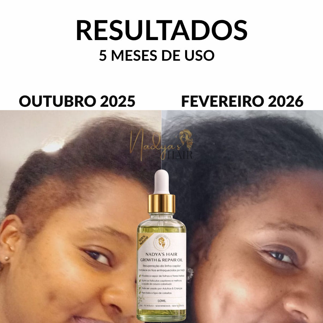 Óleo de Crescimento e Reparação da Linha Capilar