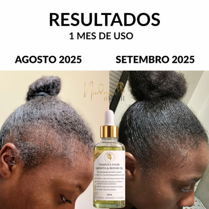 Óleo de Crescimento e Reparação da Linha Capilar